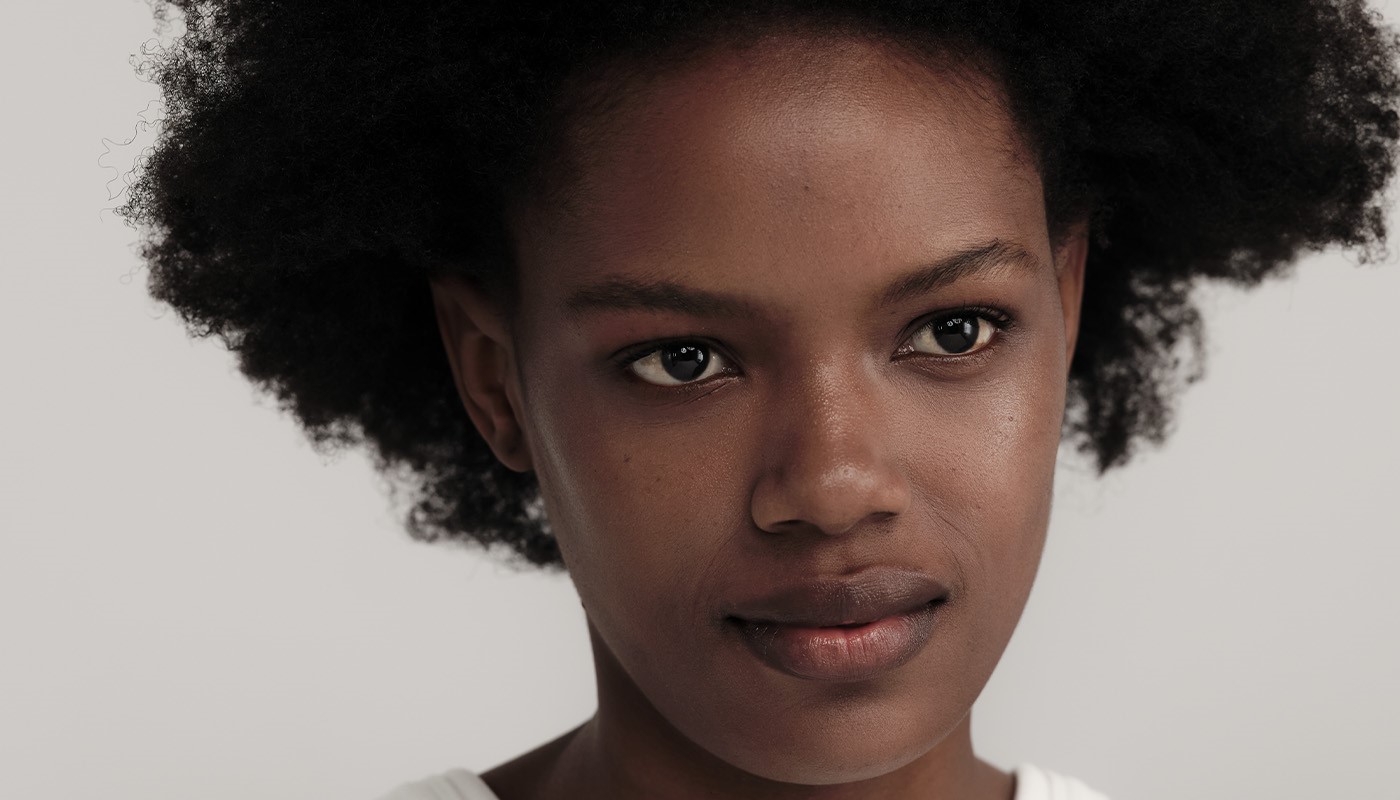 Акне у взрослых: причины, лечение и правильный уход